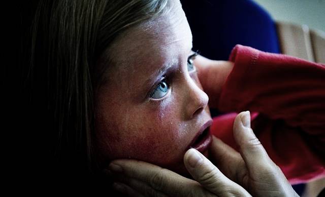 5летняя жительница Британии Аннабель Уайтхаус меняет кожу 14 раз на день